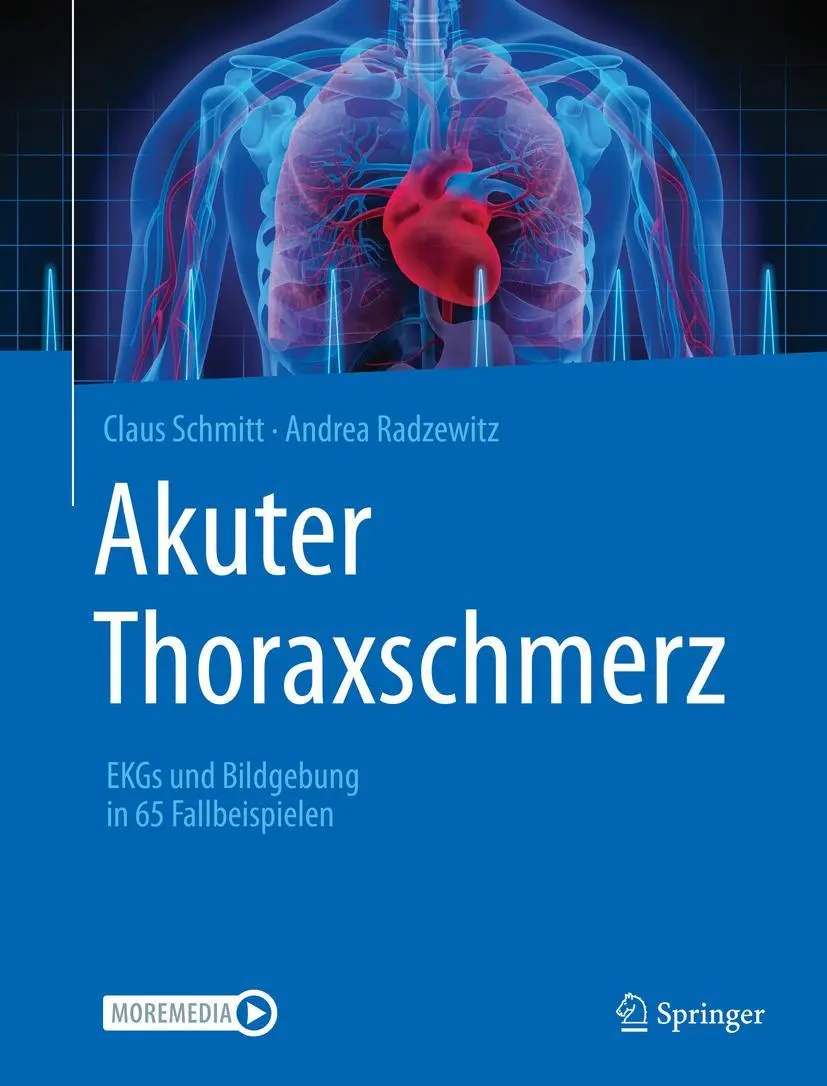 Cover: 9783662624029 | Akuter Thoraxschmerz | EKGs und Bildgebung in 65 Fallbeispielen | Buch