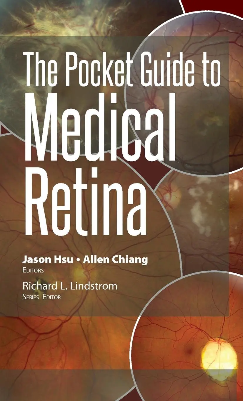 Cover: 9781630916329 | The Pocket Guide to Medical Retina | Jason Hsu (u. a.) | Taschenbuch