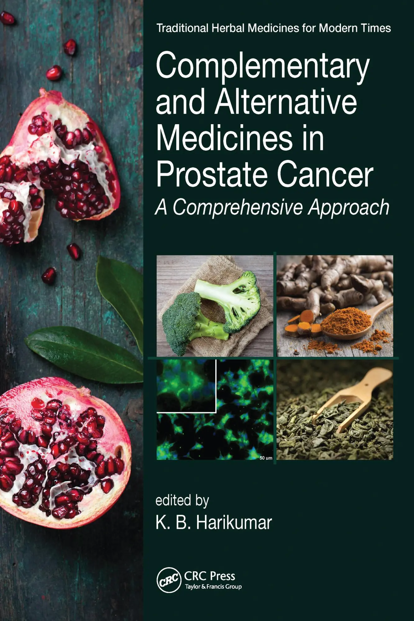 Cover: 9781032097329 | Complementary and Alternative Medicines in Prostate Cancer | Harikumar