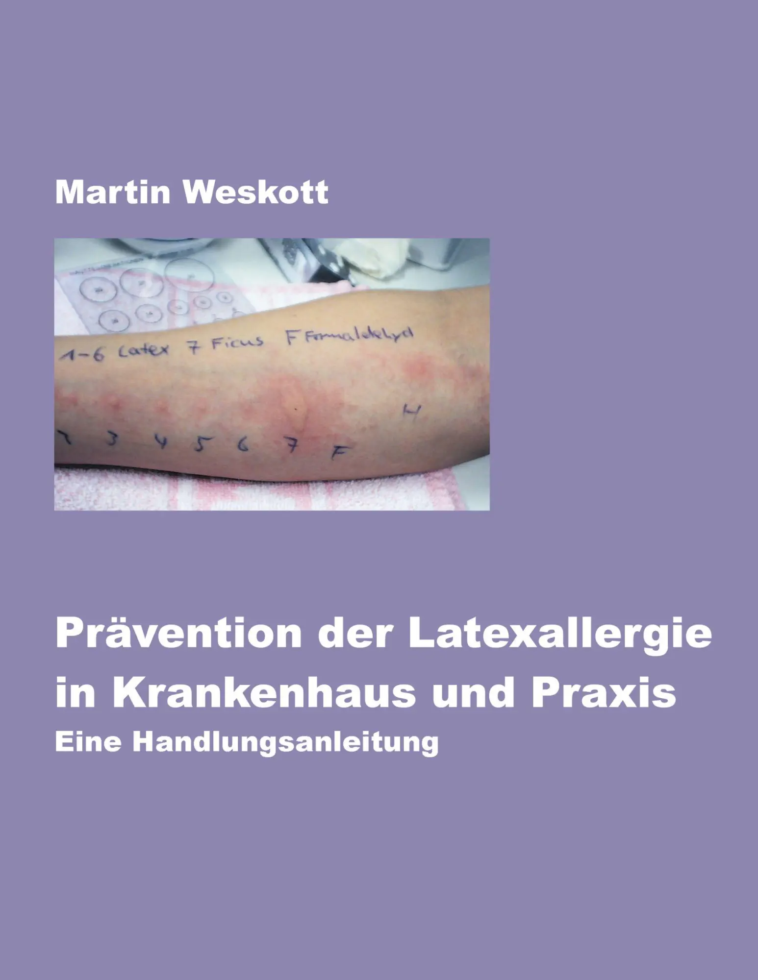 Cover: 9783831137329 | Prävention der Latexallergie in Krankenhaus und Praxis | Weskott