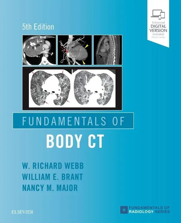 Cover: 9780323608329 | Fundamentals of Body CT | Nancy M. Major (u. a.) | Taschenbuch | 2019