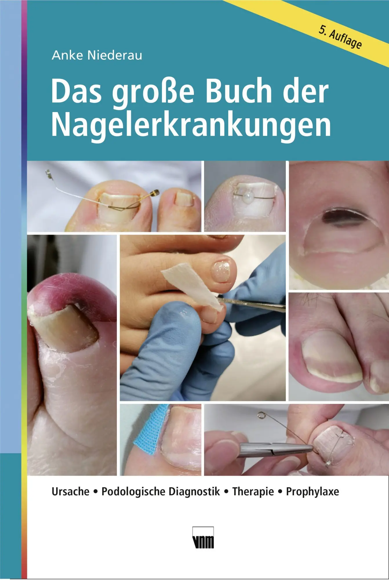 Cover: 9783954090730 | Das große Buch der Nagelerkrankungen | Anke Niederau | Buch | 320 S.