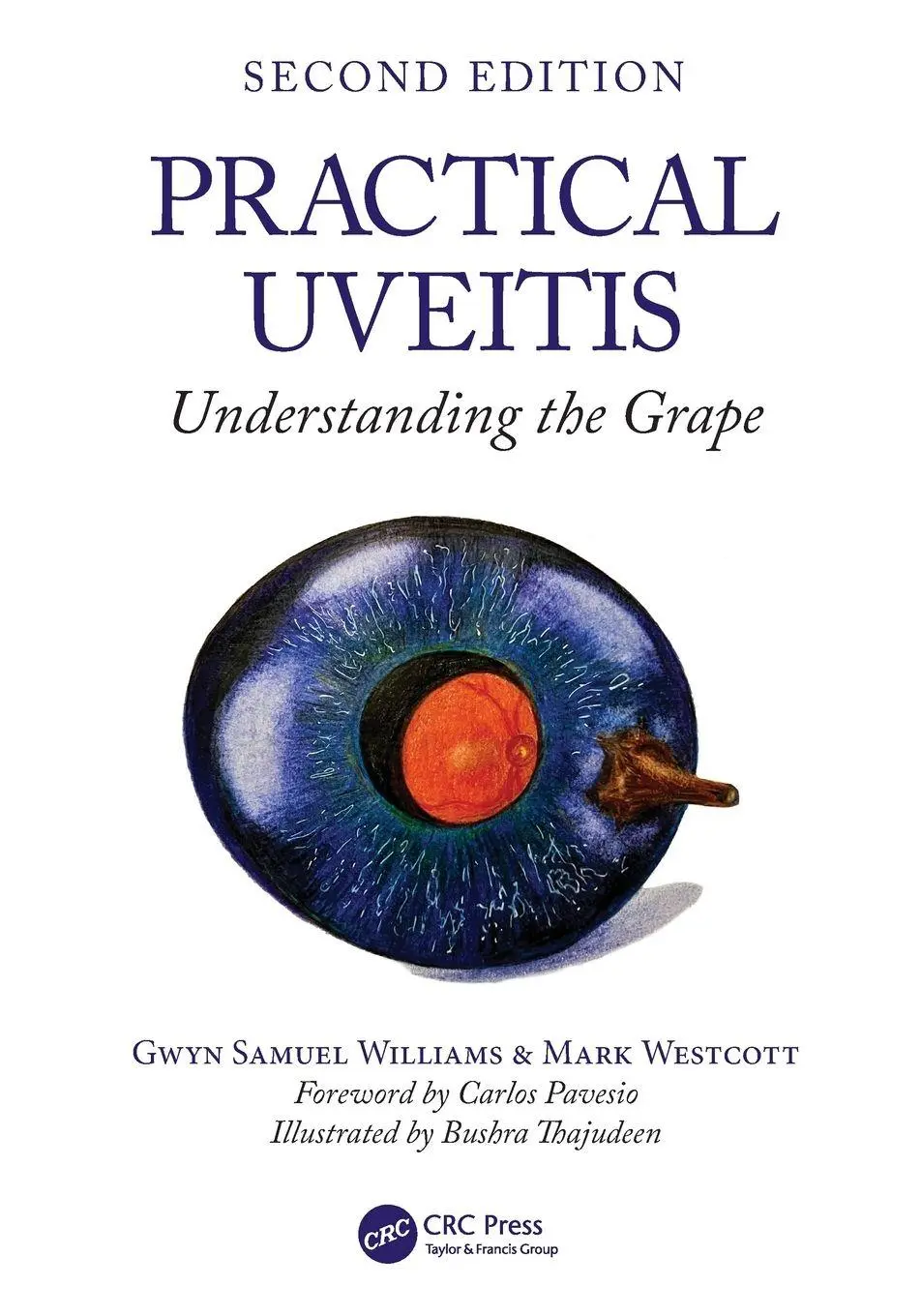Cover: 9781032757230 | Practical Uveitis | Understanding the Grape | Williams (u. a.) | Buch