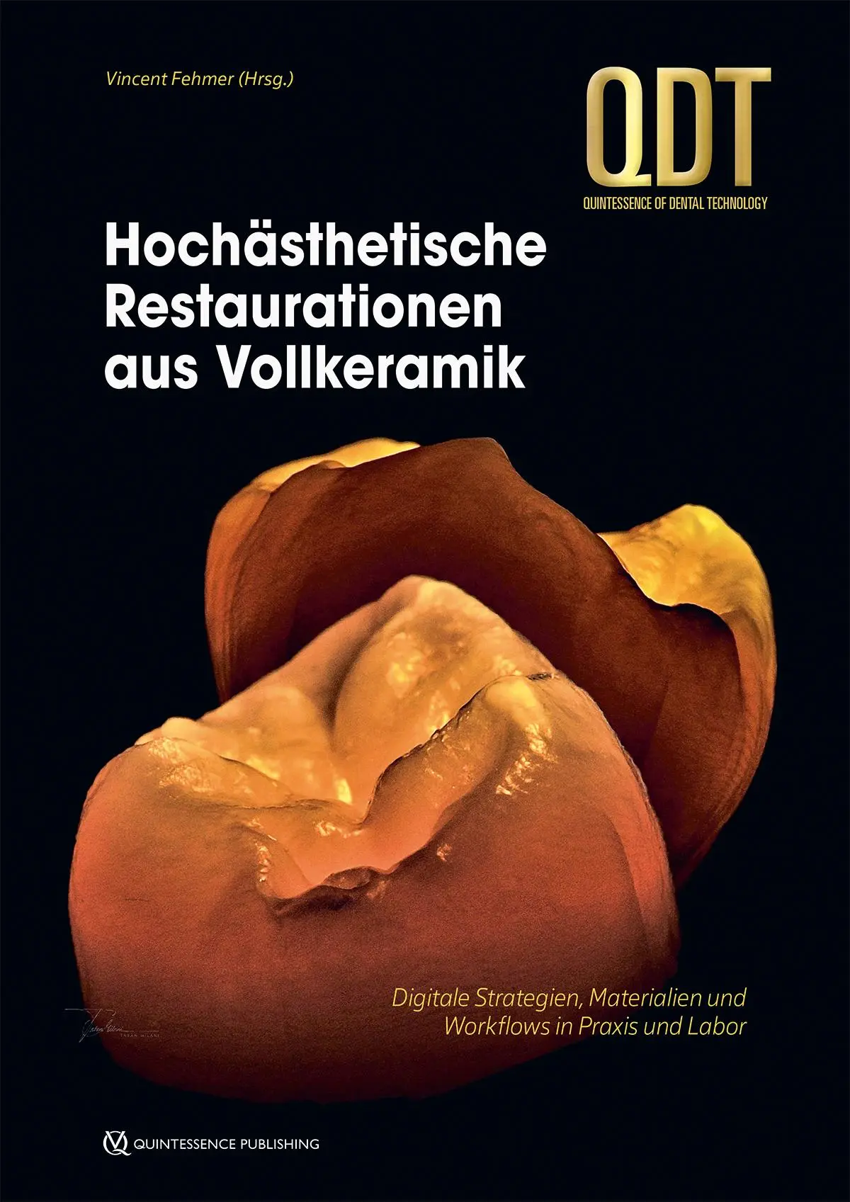Cover: 9783868677430 | Hochästhetische Restaurationen aus Vollkeramik | Vincent Fehmer | Buch