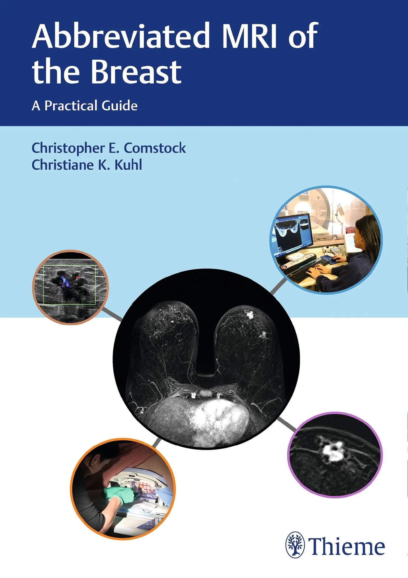 Cover: 9781626231931 | Abbreviated MRI of the Breast | A Practical Guide | Comstock (u. a.)