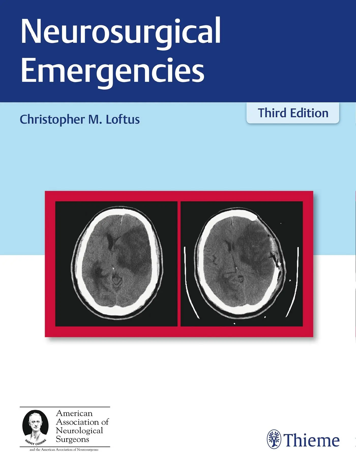 Cover: 9781626233331 | Neurosurgical Emergencies | Christopher Loftus | Buch | 392 S. | 2017