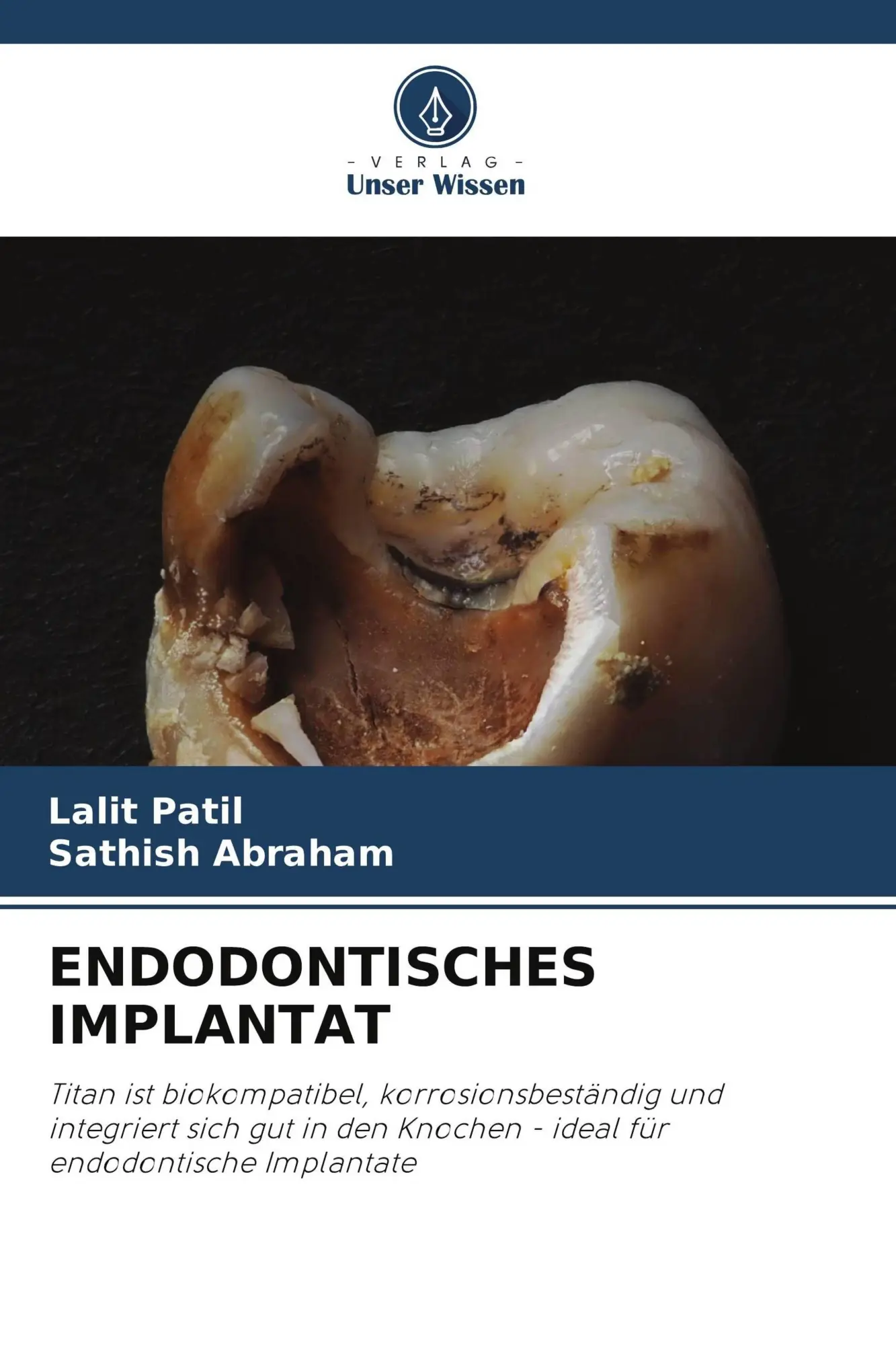 Cover: 9786209853531 | ENDODONTISCHES IMPLANTAT | Lalit Patil (u. a.) | Taschenbuch | 124 S.