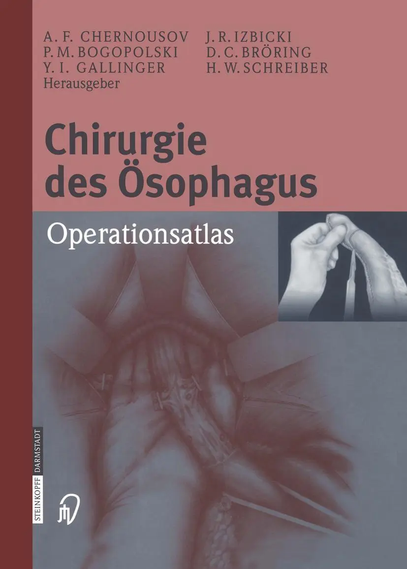 Cover: 9783642624131 | Chirurgie des Ösophagus | Operationsatlas | Yuzi I. Gallinger (u. a.)