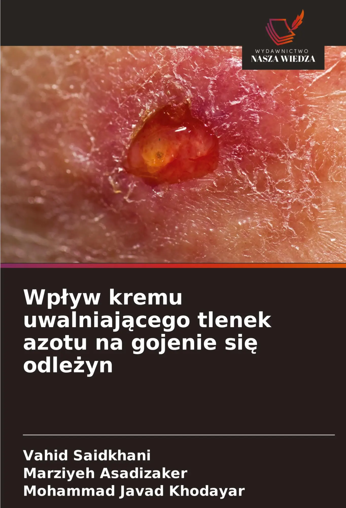 Cover: 9786208744731 | Wp¿yw kremu uwalniaj¿cego tlenek azotu na gojenie si¿ odle¿yn | Buch