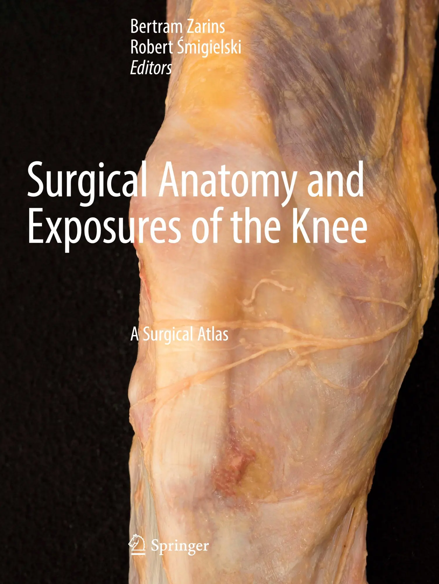Cover: 9783031476631 | Surgical Anatomy and Exposures of the Knee | A Surgical Atlas | Buch