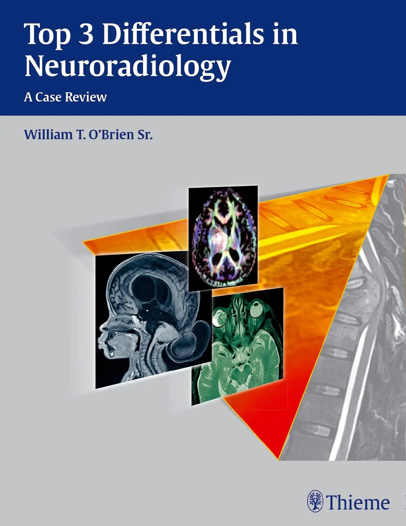 Cover: 9781604067231 | Top 3 Differentials in Neuroradiology | A Case Review | O'Brien | Buch