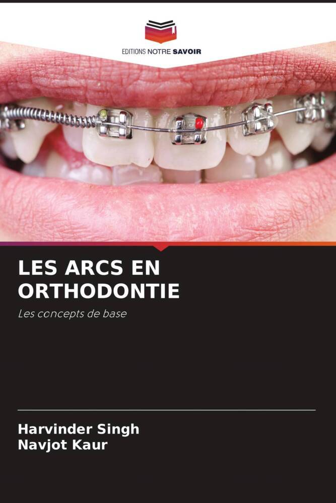 Cover: 9786206088431 | LES ARCS EN ORTHODONTIE | Les concepts de base | Singh (u. a.) | Buch