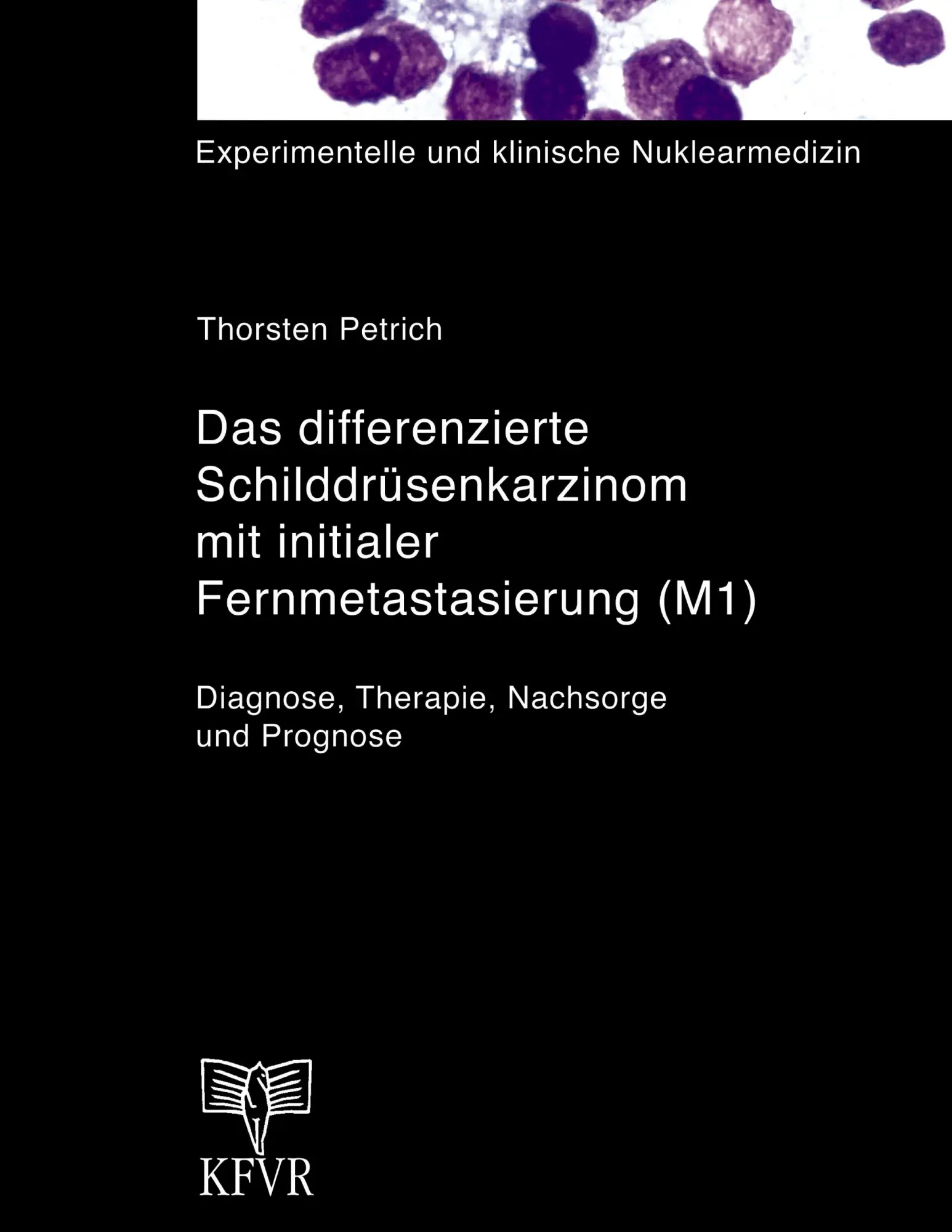 Cover: 9783831102532 | Das differenzierte Schilddrüsenkarzinom mit initialer...