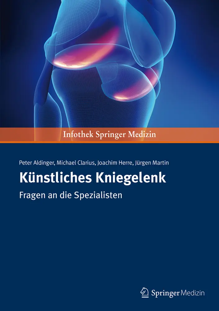 Cover: 9783899352832 | Künstliches Kniegelenk | Fragen an die Spezialisten | Aldinger | Buch