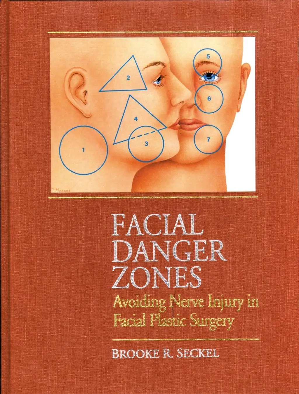 Cover: 9781626235632 | Facial Danger Zones | Avoiding Nerve Injury in Facial Plastic Surgery
