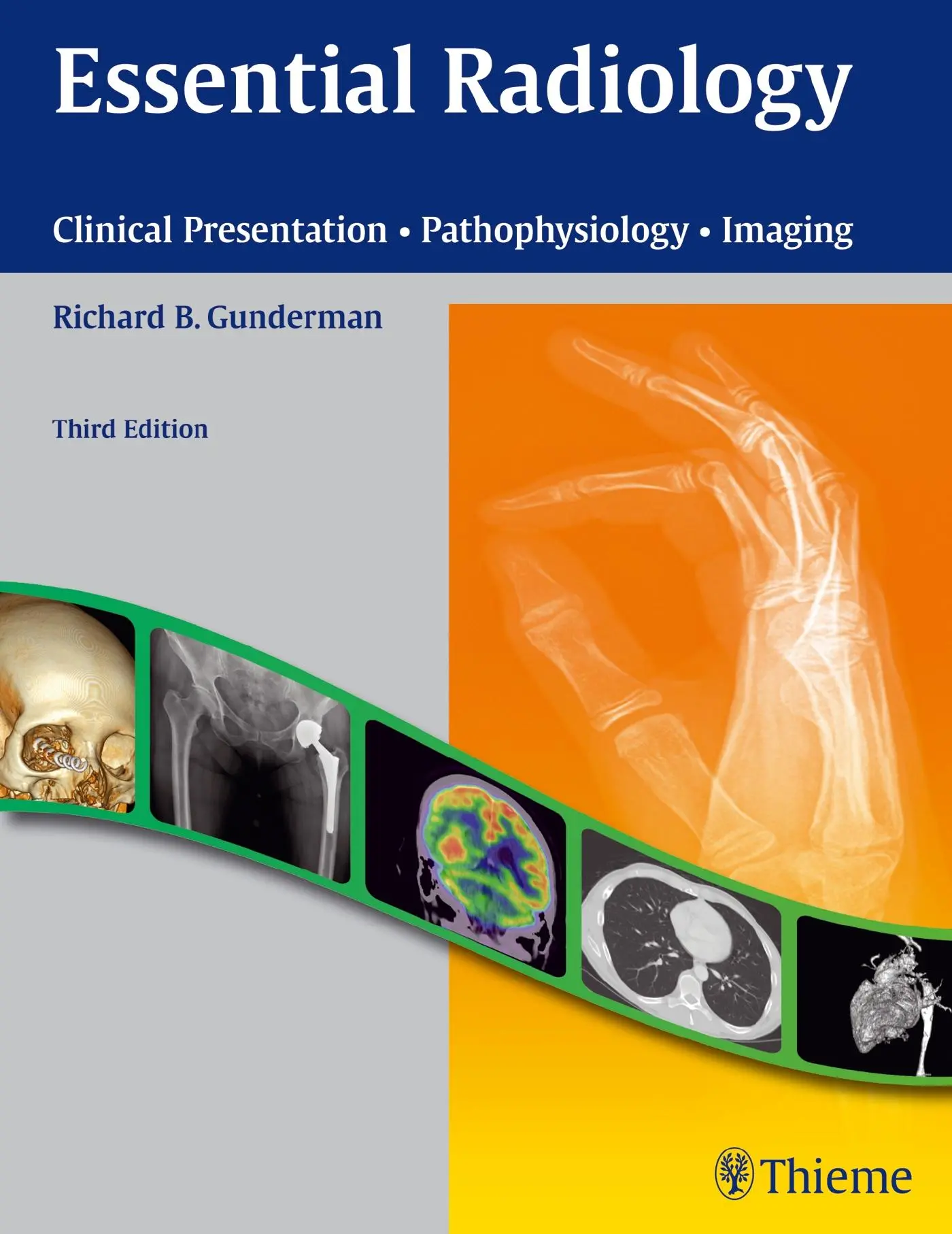 Cover: 9781604065732 | Essential Radiology | Richard B Gunderman | Taschenbuch | 344 S.