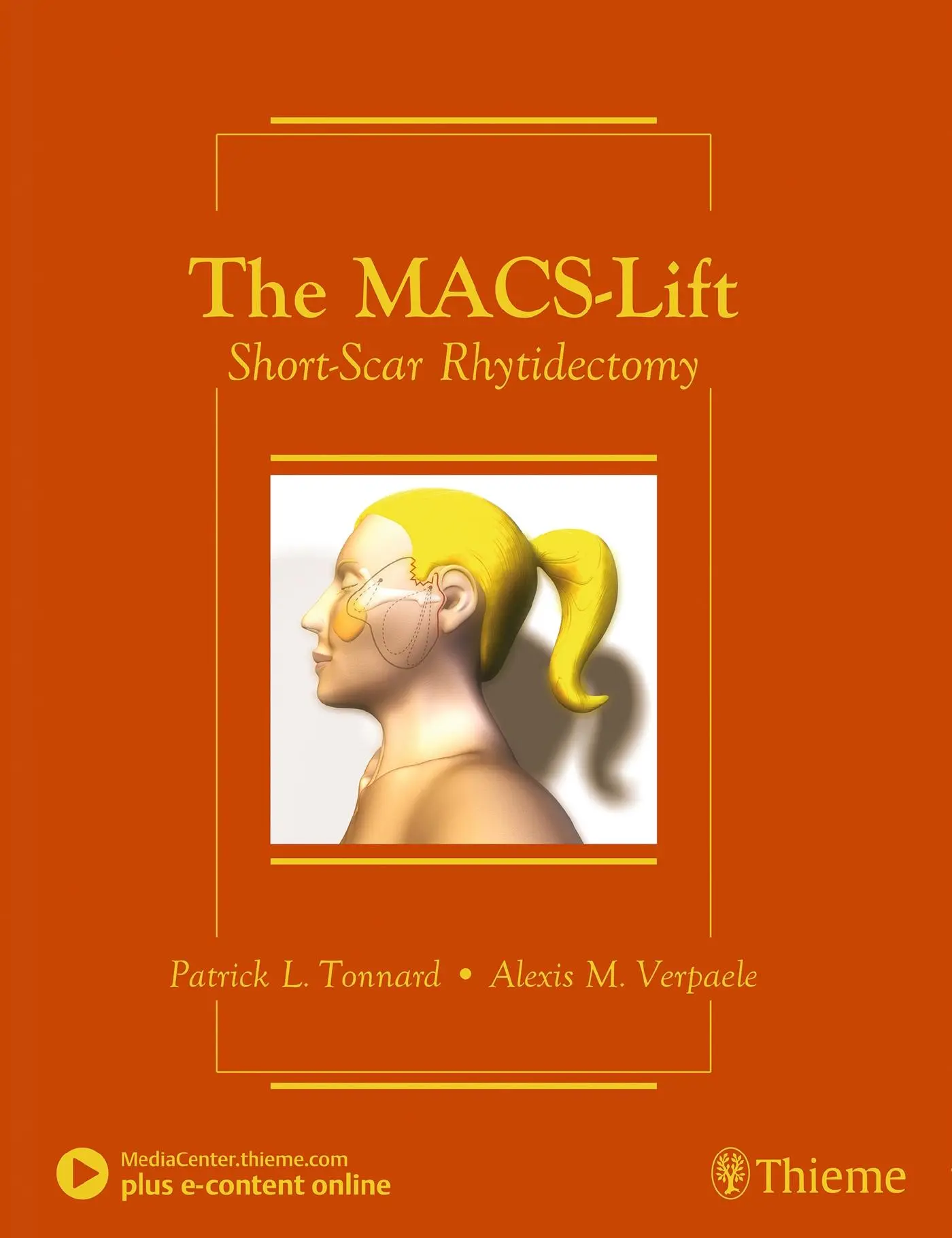 Cover: 9781626236332 | The Macs-Lift | Short-Scar Rhytidectomy | Patrick Tonnard (u. a.)