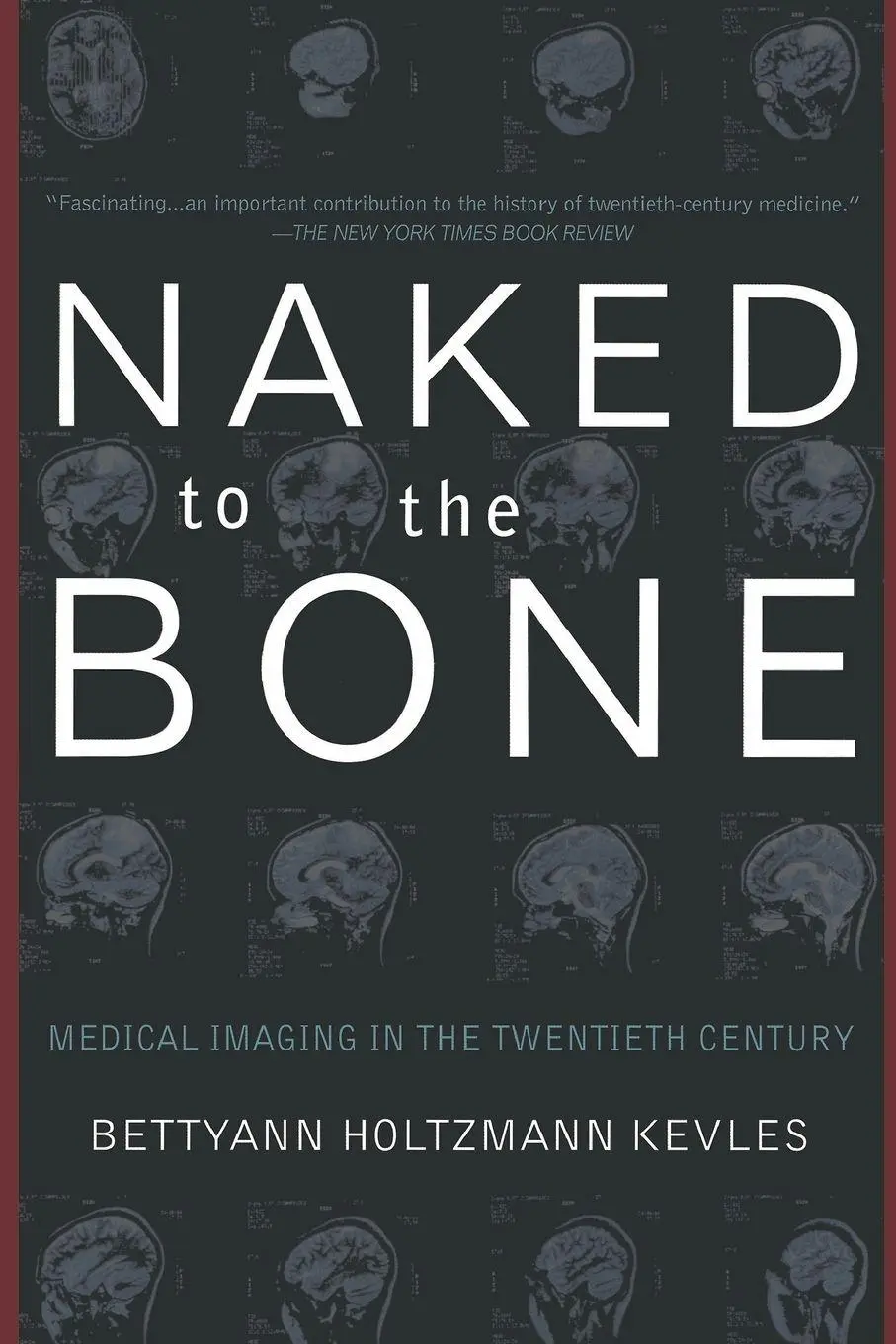 Cover: 9780201328332 | Naked to the Bone | Medical Imaging in the Twentieth Century | Kevles