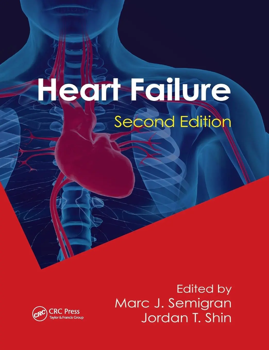 Cover: 9780367380533 | Heart Failure | Marc Semigran (u. a.) | Taschenbuch | Englisch | 2019