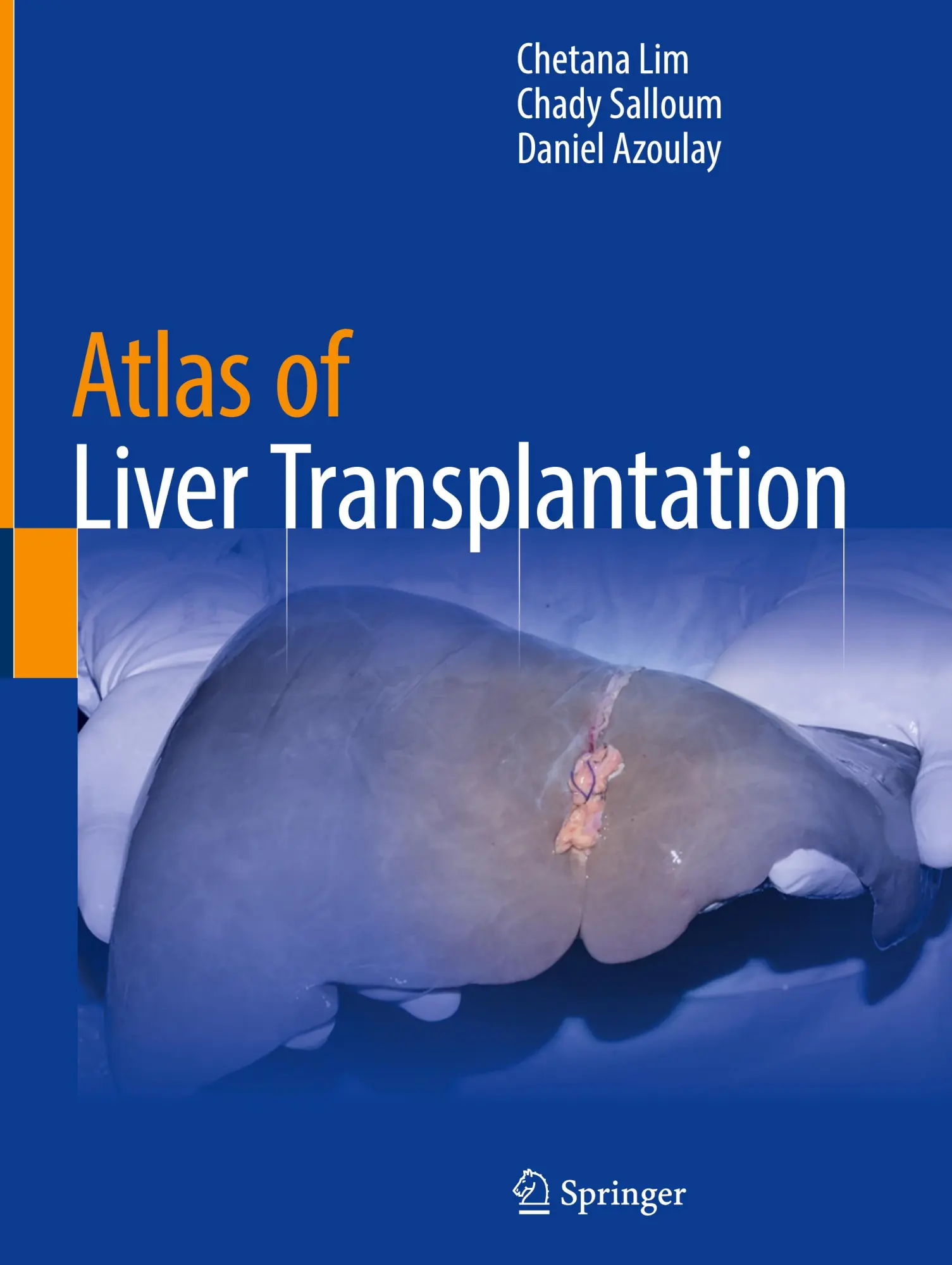 Cover: 9783031852633 | Atlas of Liver Transplantation | Chetana Lim (u. a.) | Buch | xi