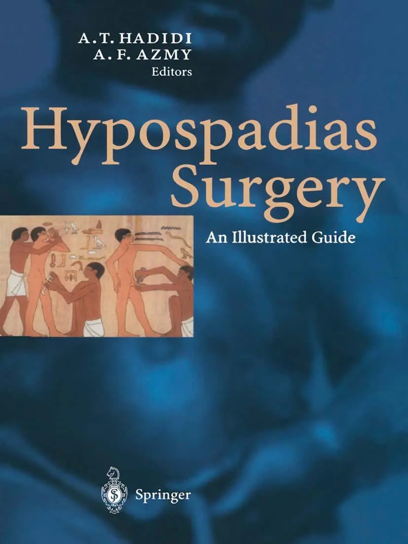 Cover: 9783662078433 | Hypospadias Surgery | An Illustrated Guide | A. (u. a.) | Taschenbuch