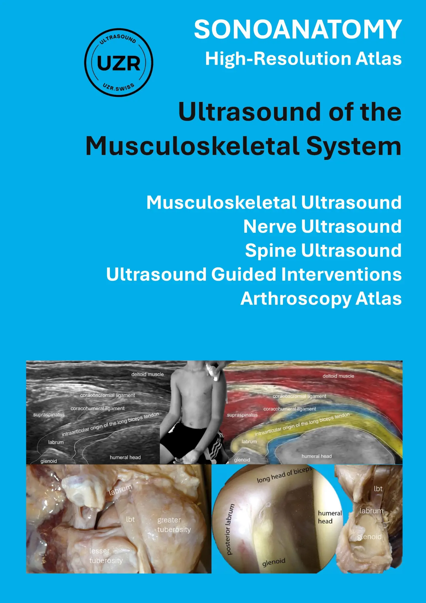 Cover: 9783769309133 | Sonoanatomy - High-Resolution Atlas - Ultrasound of the...