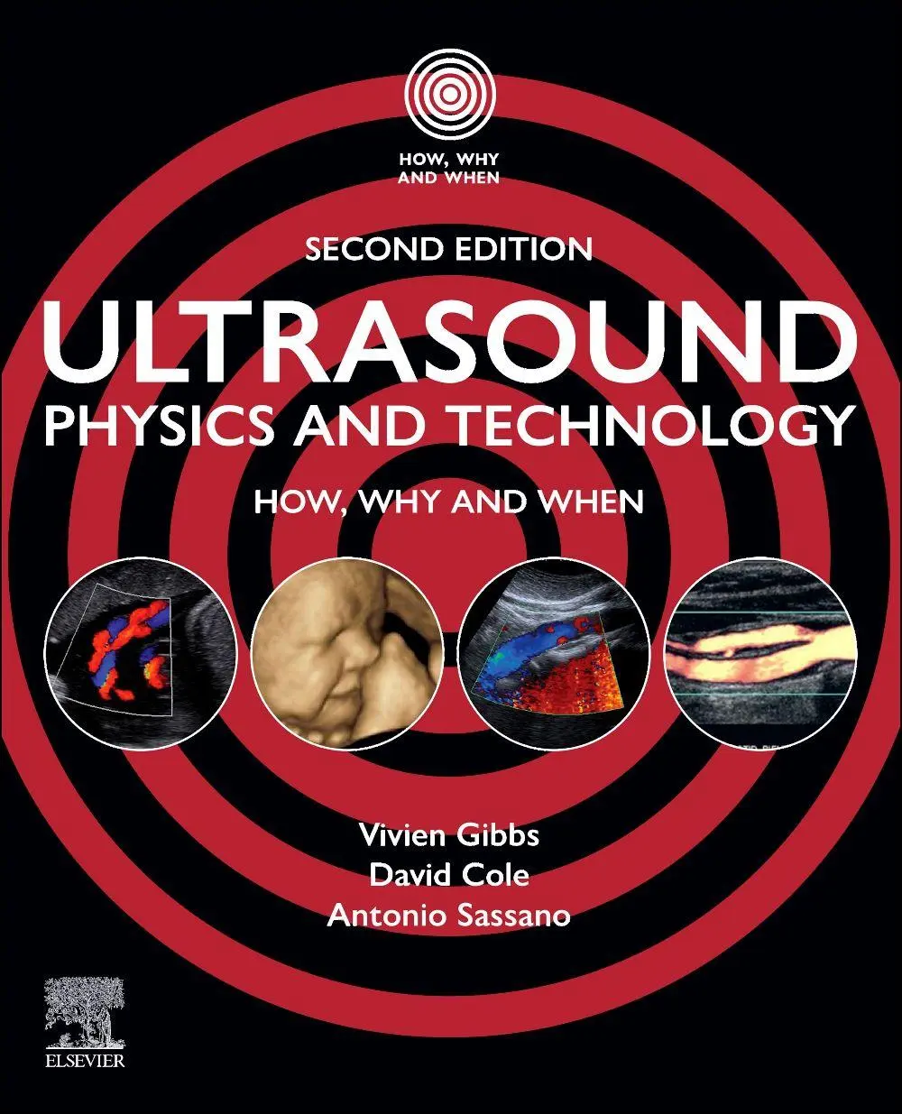 Cover: 9780443409233 | Ultrasound Physics and Technology | How, Why and When | Taschenbuch