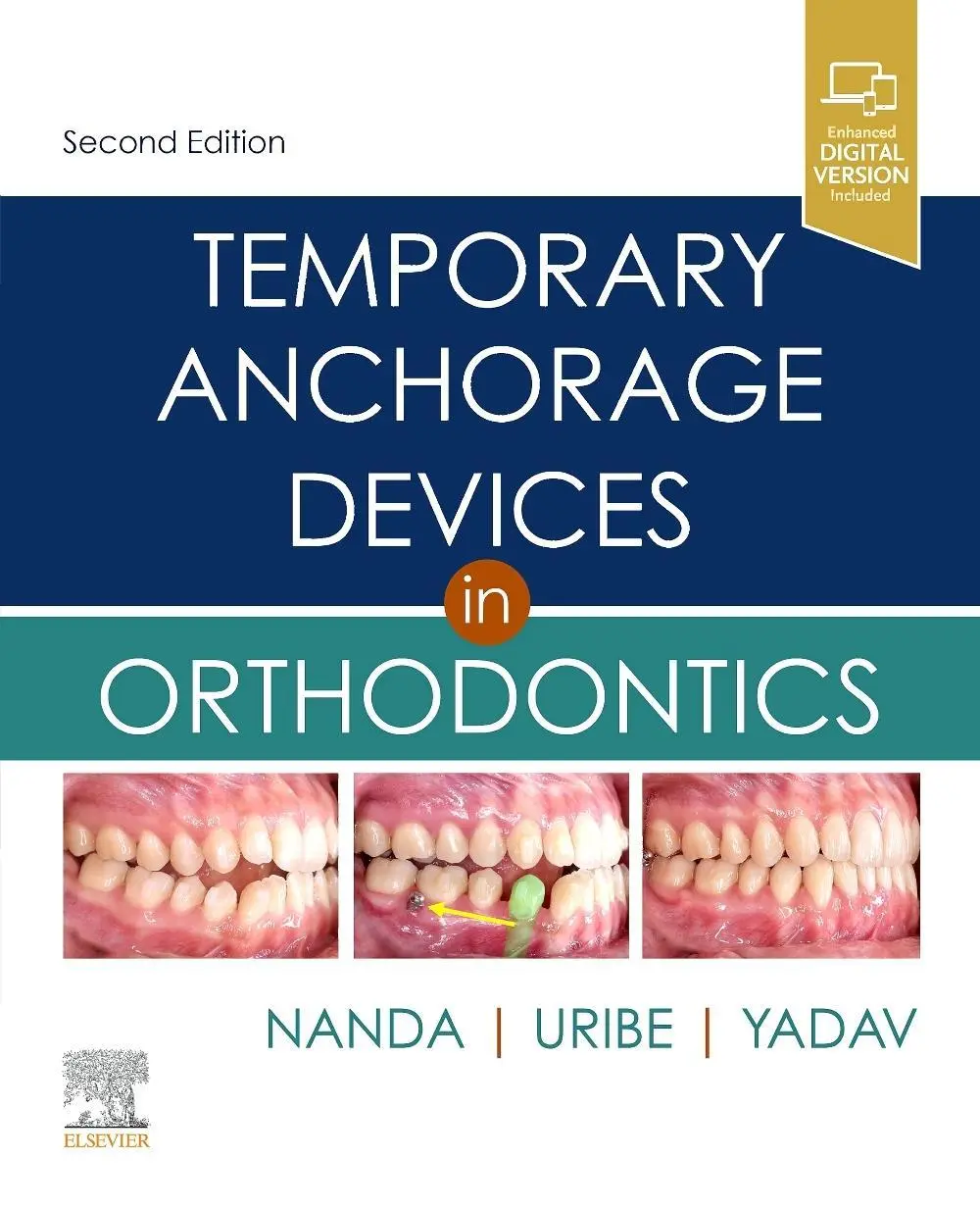 Cover: 9780323609333 | Temporary Anchorage Devices in Orthodontics | Uribe (u. a.) | Buch