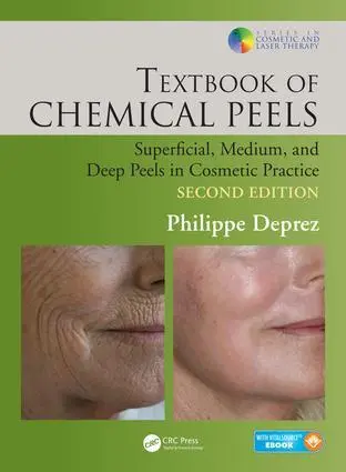 Cover: 9781482223934 | Textbook of Chemical Peels | Philippe Deprez | Buch | Englisch | 2016