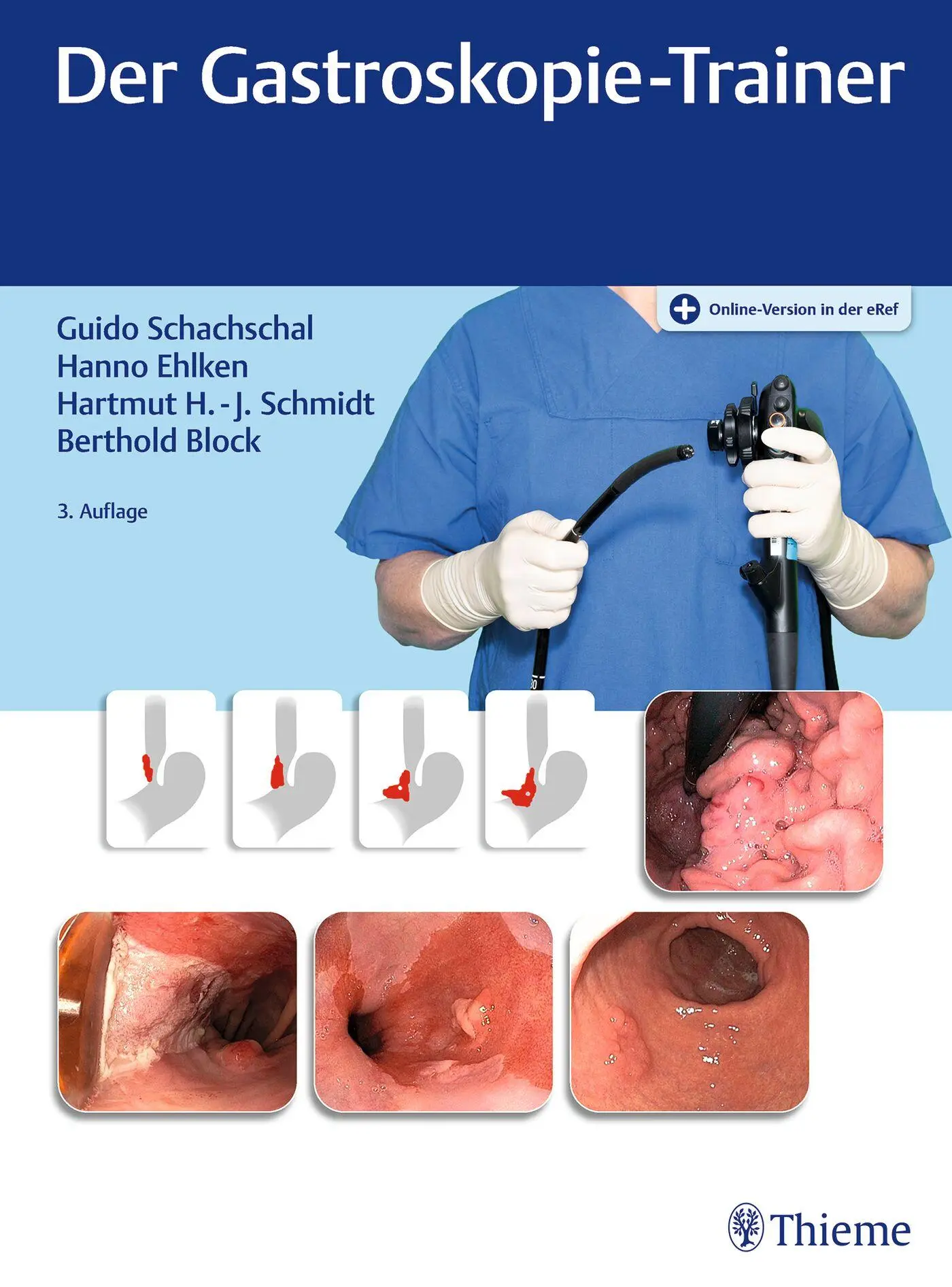 Cover: 9783131354334 | Der Gastroskopie-Trainer | Guido Schachschal (u. a.) | Bundle | 1 Buch Cover: 9783131354334 | Der Gastroskopie-Trainer | Guido Schachschal (u. a.) | Bundle | 1 Buch