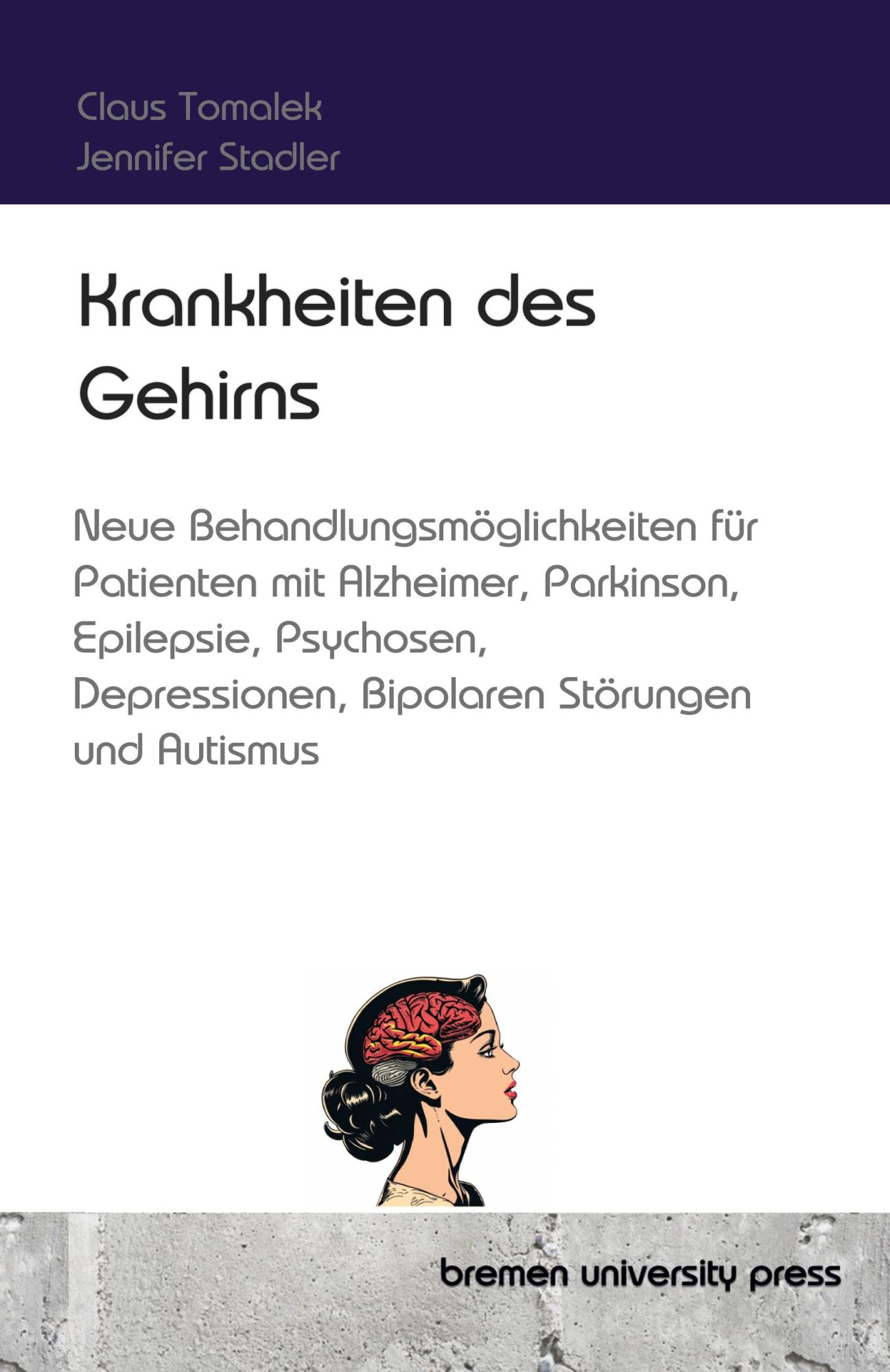 Cover: 9783689044534 | Krankheiten des Gehirns | Claus Tomalek | Taschenbuch | 292 S. | 2024