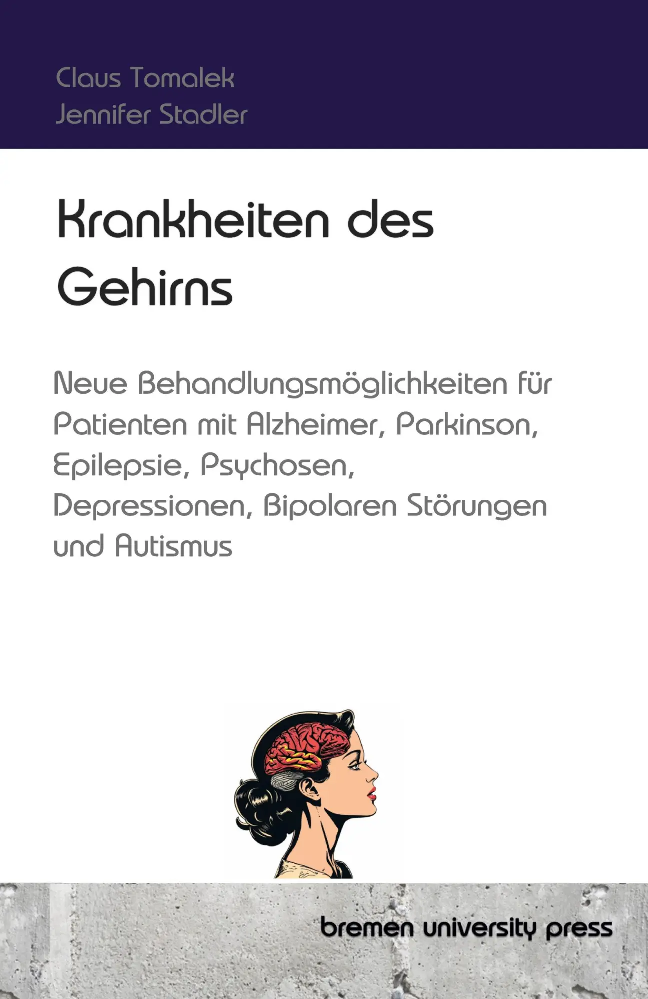 Cover: 9783689044534 | Krankheiten des Gehirns | Claus Tomalek | Taschenbuch | 292 S. | 2024