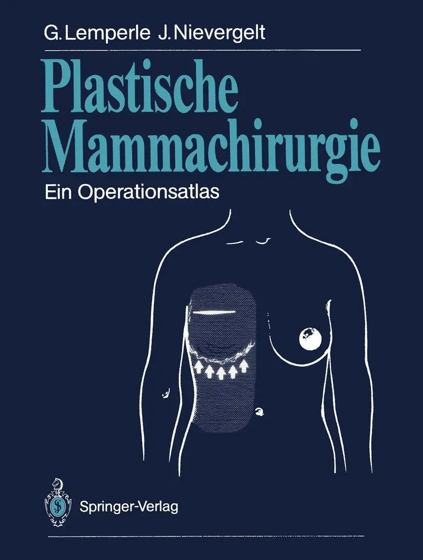 Cover: 9783642475634 | Plastische Mammachirurgie | Ein Operationsatlas | Lemperle (u. a.) | x