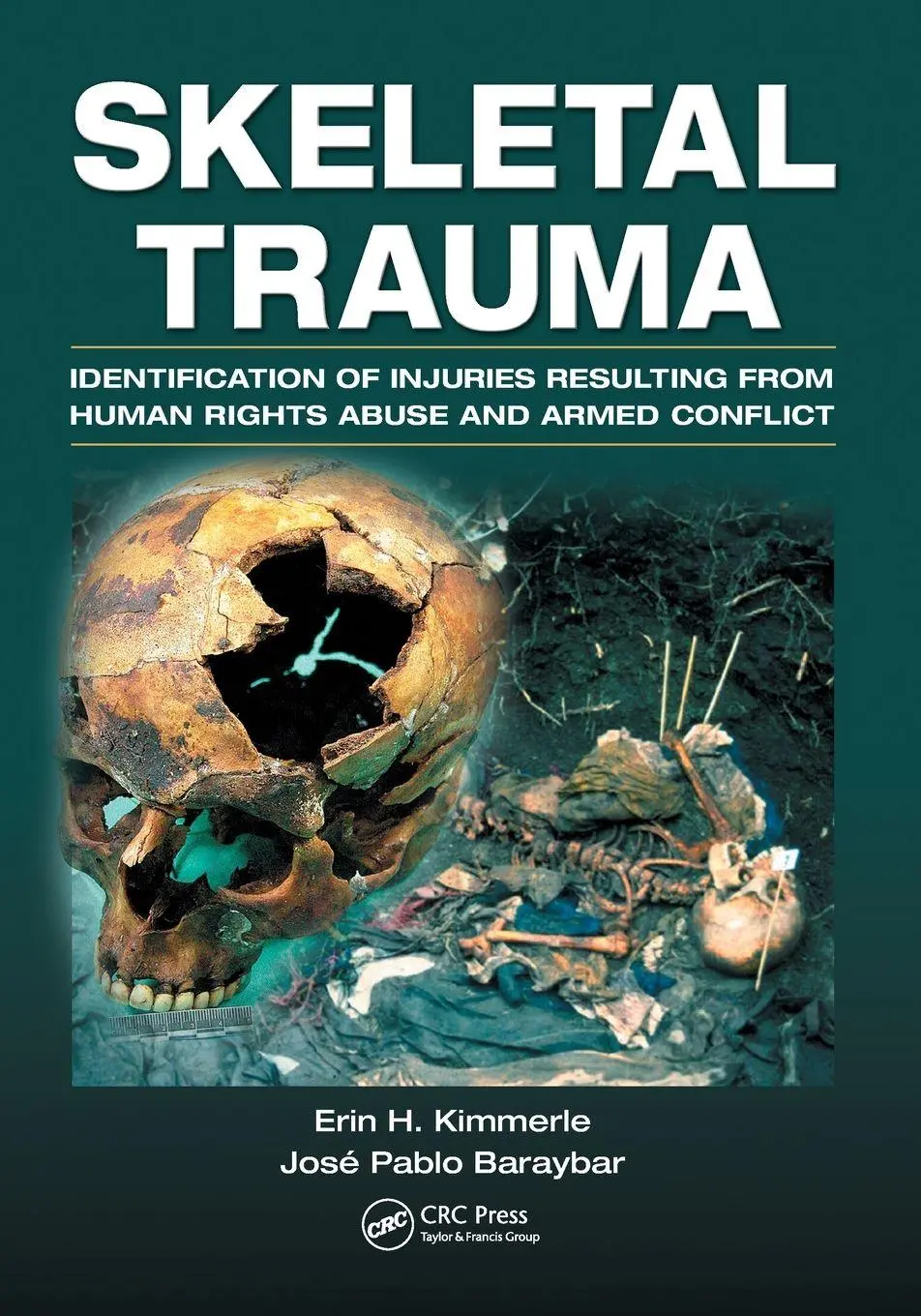 Cover: 9781032919034 | Skeletal Trauma | Erin H. Kimmerle (u. a.) | Taschenbuch | Englisch
