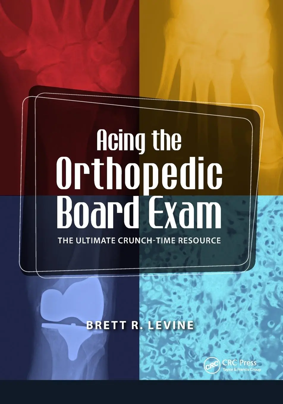 Cover: 9781556429934 | Acing the Orthopedic Board Exam | The Ultimate Crunch Time Resource