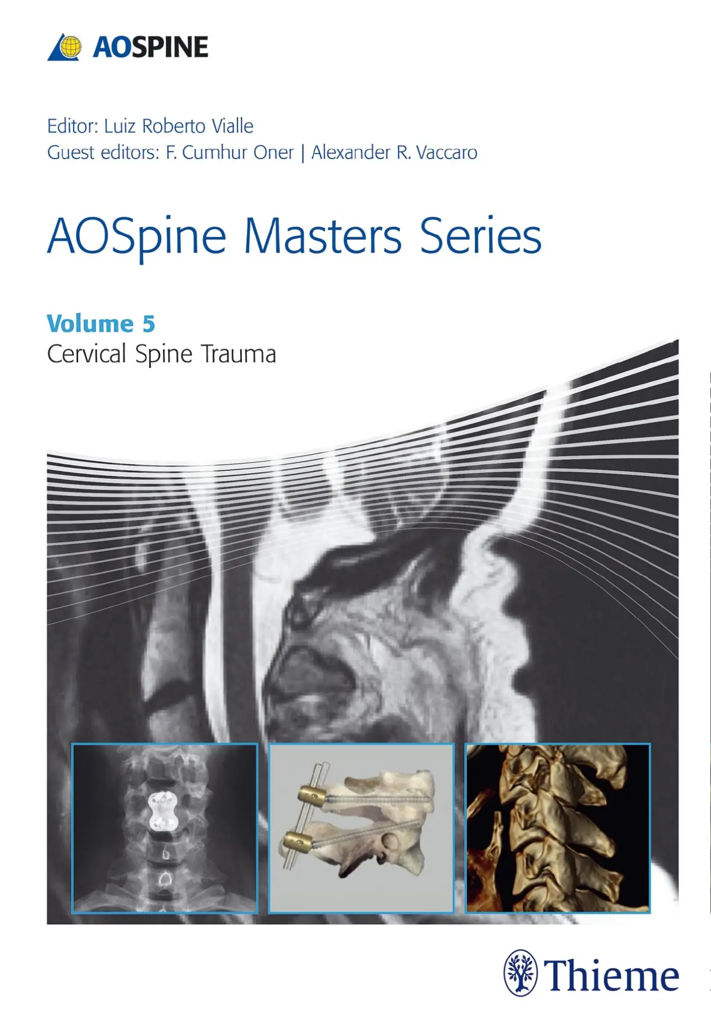 Cover: 9781626232235 | Aospine Masters Series, Volume 5: Cervical Spine Trauma | Vialle