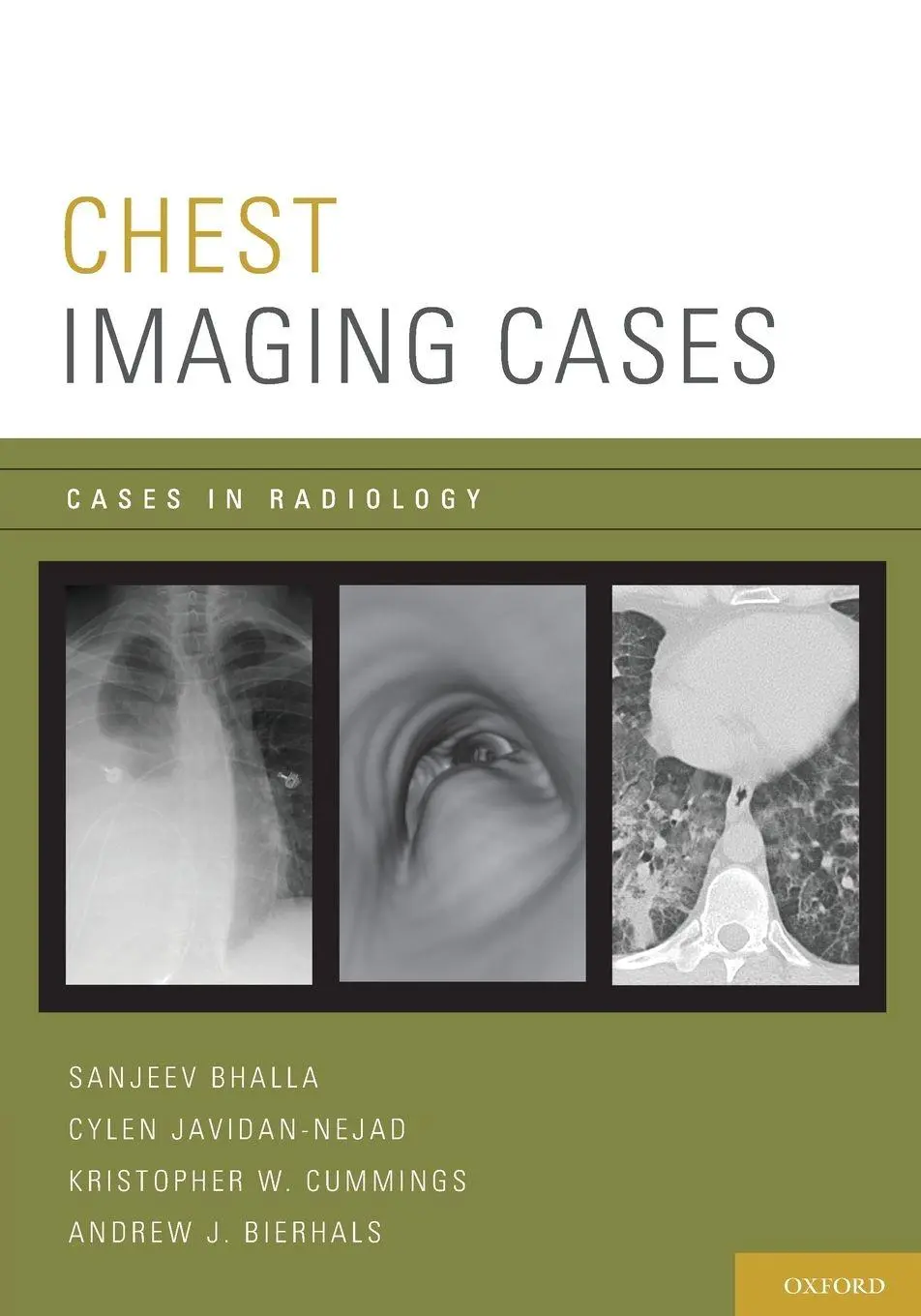 Cover: 9780195394535 | Chest Imaging Cases | Sanjeev Bhalla (u. a.) | Taschenbuch | Englisch