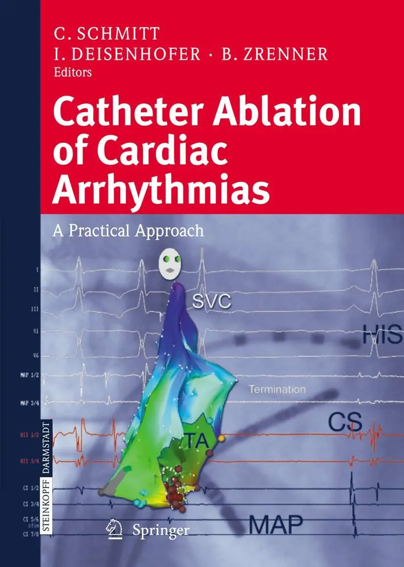 Cover: 9783662526835 | Catheter Ablation of Cardiac Arrhythmias | A Practical Approach | Buch