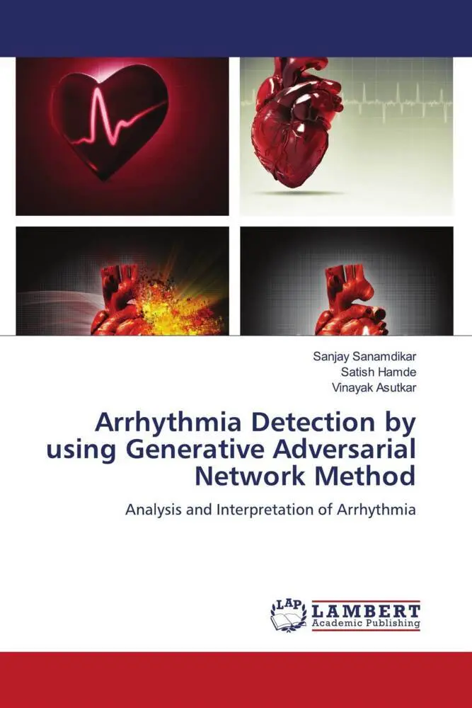 Cover: 9786206739135 | Arrhythmia Detection by using Generative Adversarial Network Method