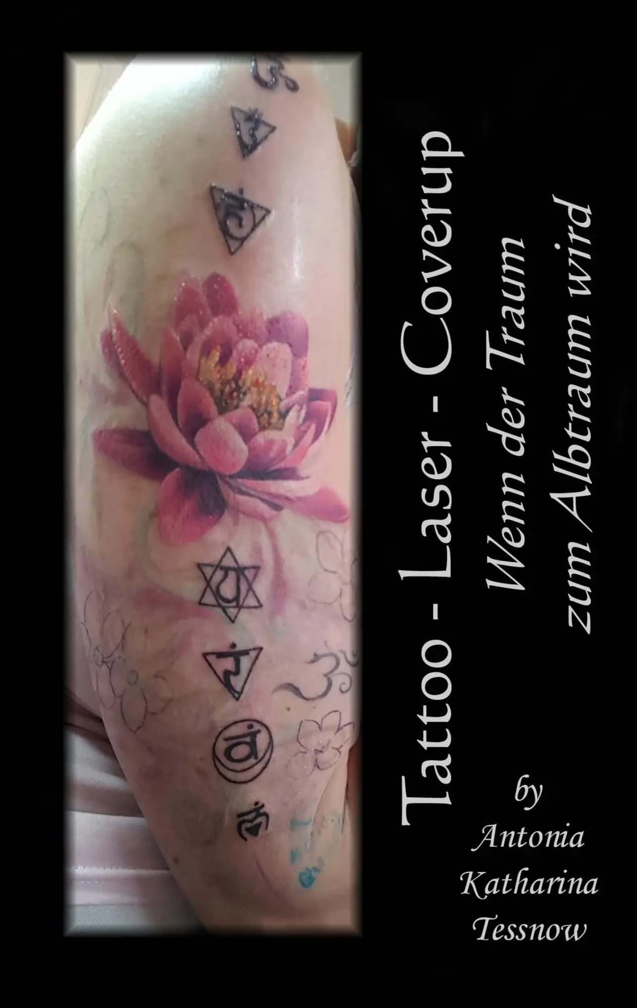 Cover: 9783740734336 | Tattoo - Laser - Cover Up | Wenn der Traum zum Albtraum wird | Tessnow