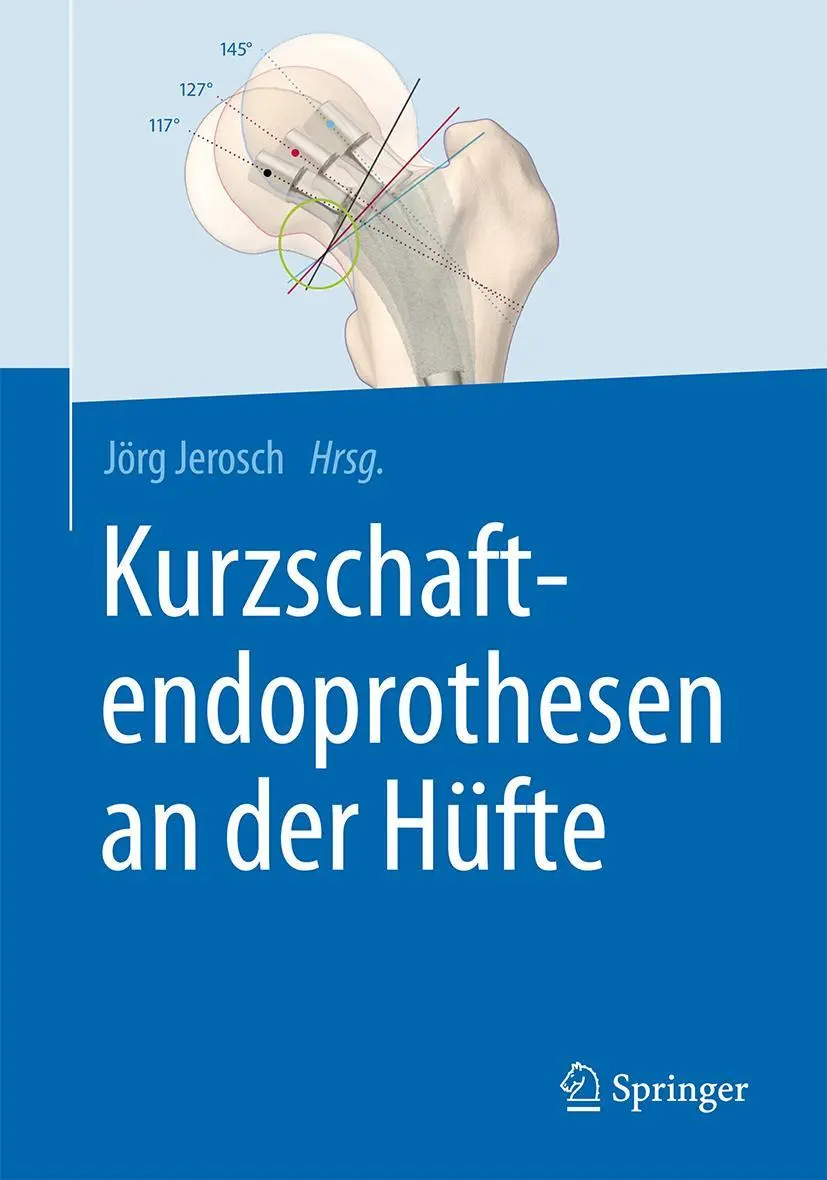 Cover: 9783662527436 | Kurzschaftendoprothesen an der Hüfte | Jörg Jerosch | Buch | xvi