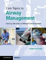 Cover: 9781108419536 | Core Topics in Airway Management | Tim Cook (u. a.) | Buch | Gebunden Cover: 9781108419536 | Core Topics in Airway Management | Tim Cook (u. a.) | Buch | Gebunden