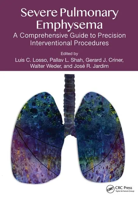 Cover: 9781032170237 | Severe Pulmonary Emphysema: | Gerald J. Criner (u. a.) | Taschenbuch