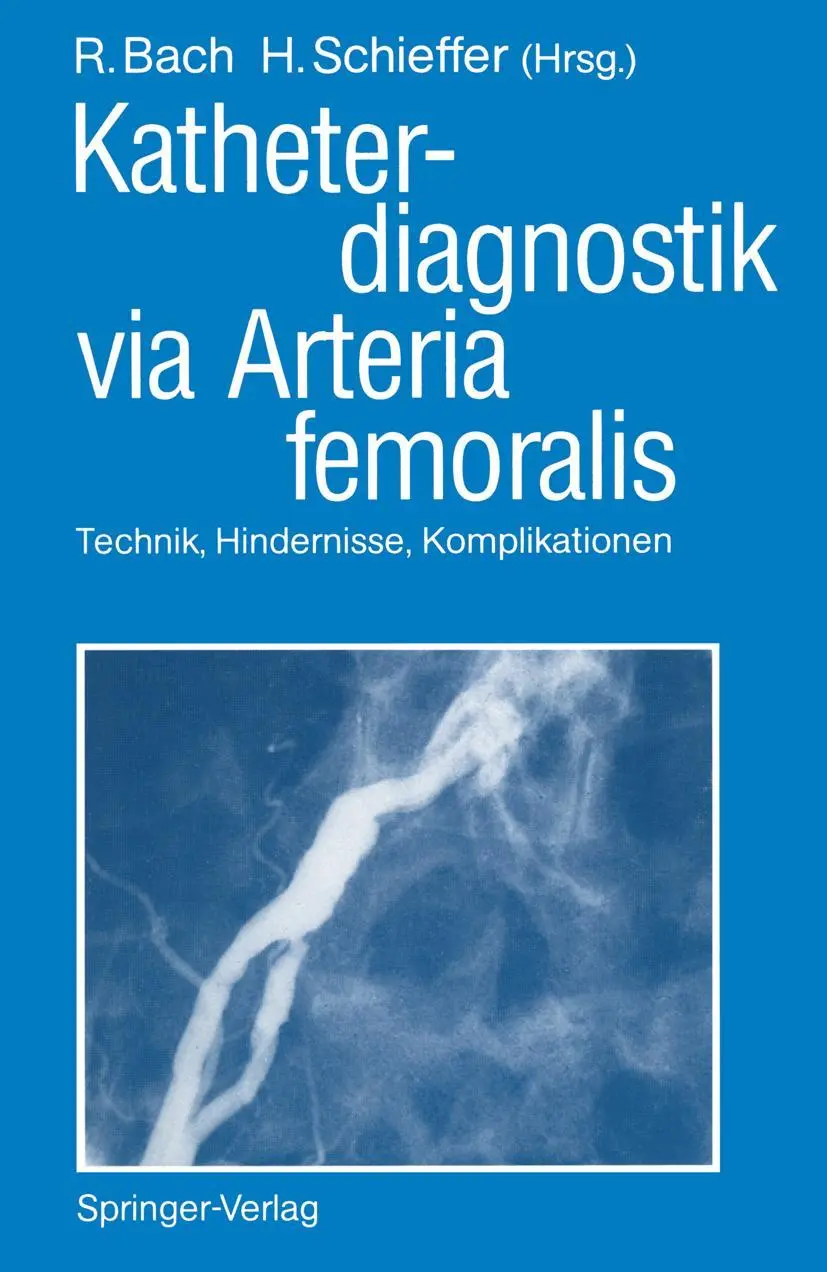 Cover: 9783540520337 | Katheterdiagnostik via Arteria femoralis | Schieffer (u. a.) | Buch