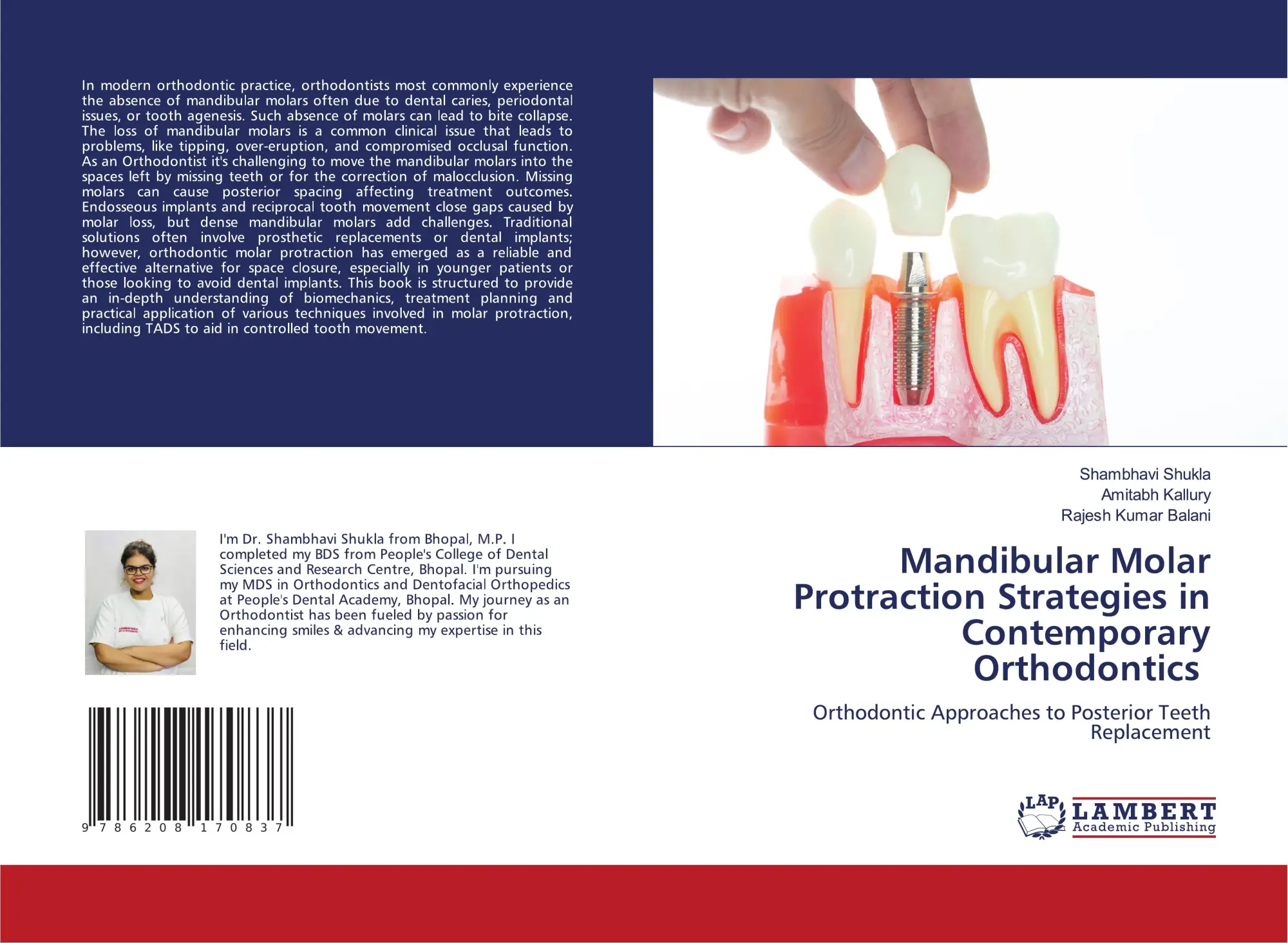 Cover: 9786208170837 | Mandibular Molar Protraction Strategies in Contemporary Orthodontics