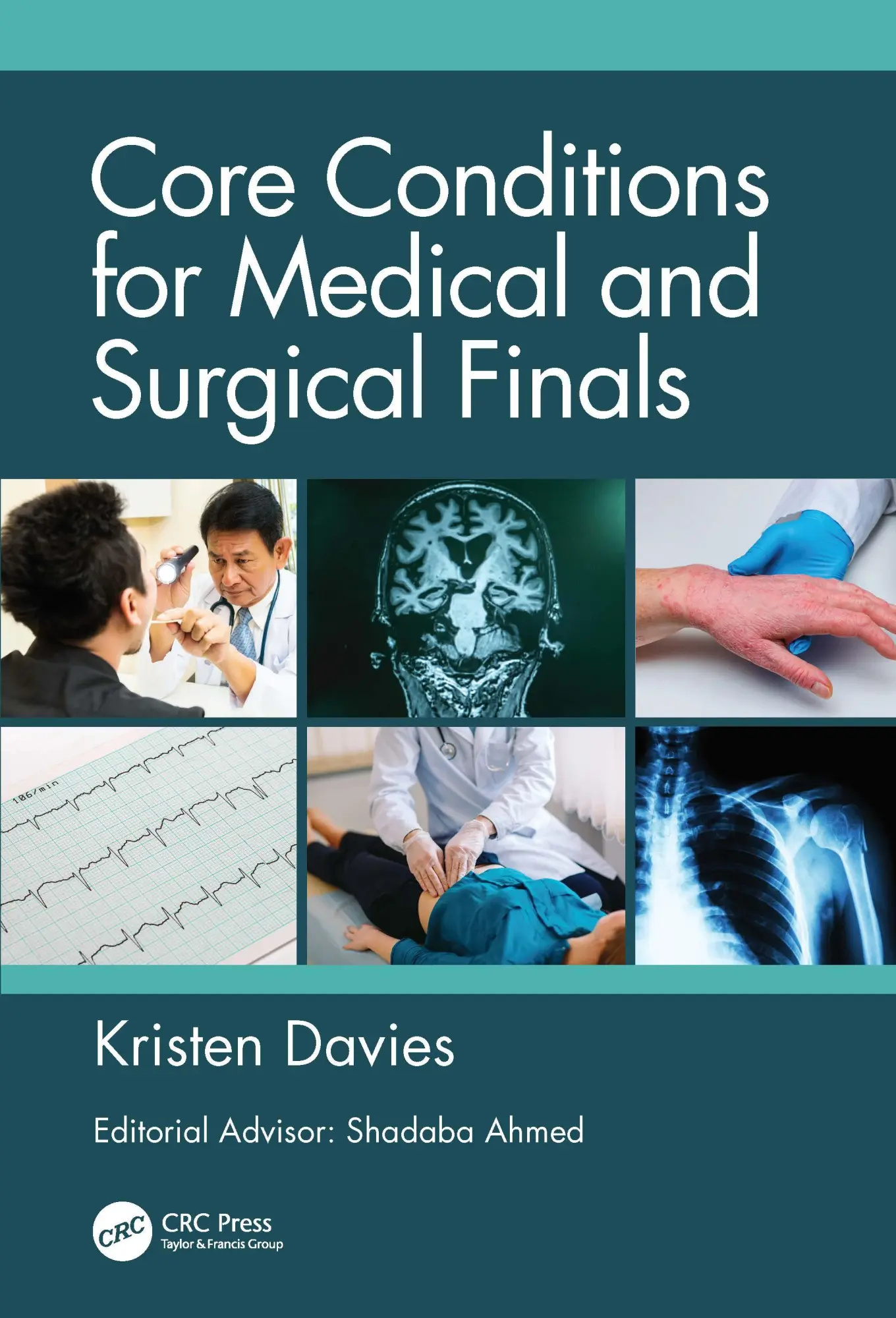 Cover: 9781138331037 | Core Conditions for Medical and Surgical Finals | Kristen Davies