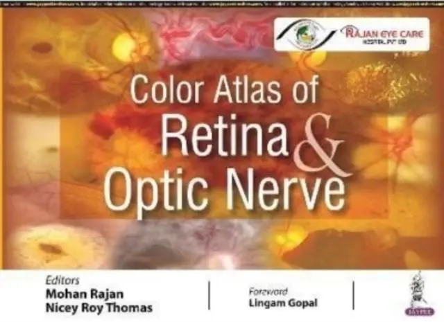 Cover: 9789354651137 | Color Atlas of Retina &amp; Optic Nerve | Mohan Rajan (u. a.) | Buch