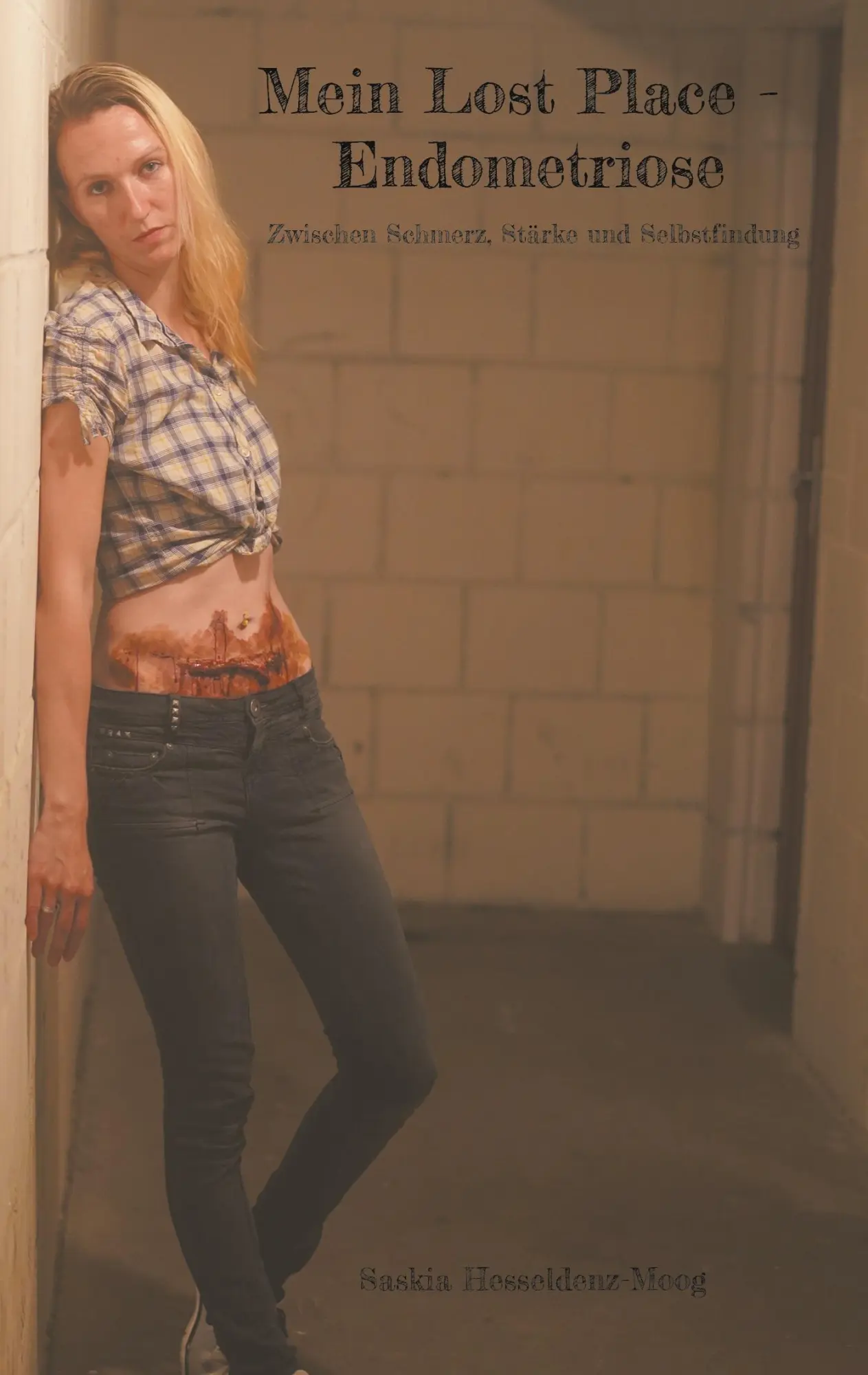 Cover: 9783695161737 | Mein Lost Place - Endometriose | Saskia Hesseldenz-Moog | Taschenbuch