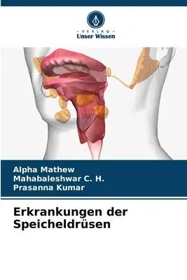 Cover: 9786206016137 | Erkrankungen der Speicheldrüsen | Alpha Mathew (u. a.) | Taschenbuch