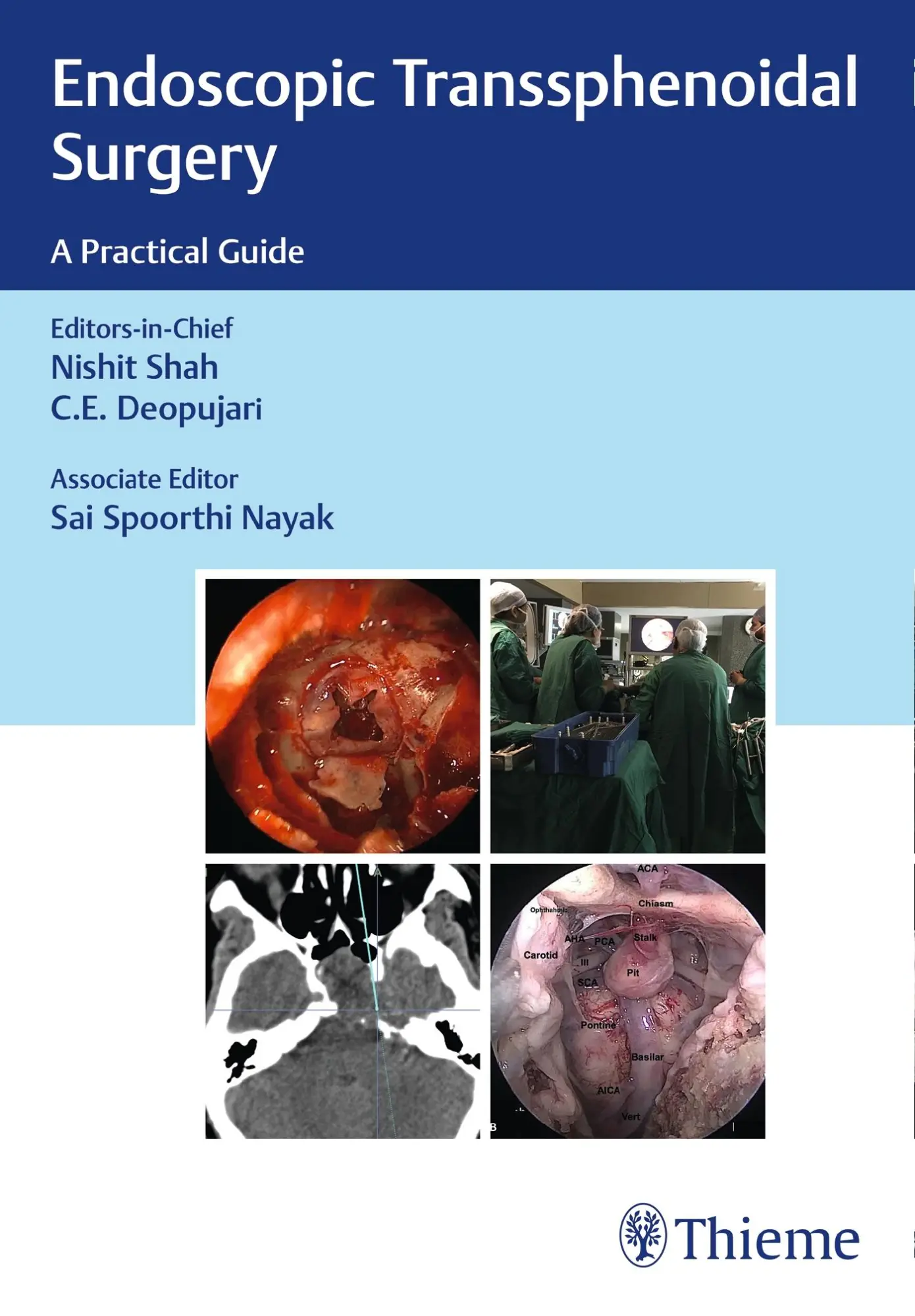 Cover: 9789388257237 | Endoscopic Transsphenoidal Surgery | A Practical Guide | Shar | Buch